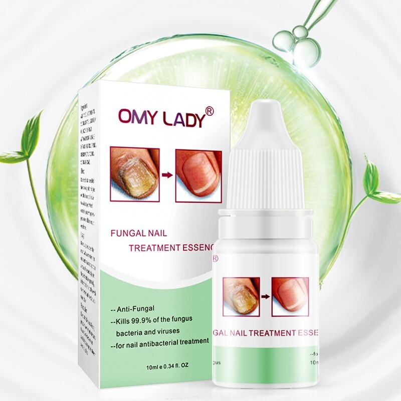 Восстанавливающий крем для ногтей Omy Lady Fungal Nails Treatment, 10мл. Артикул: IXI60702